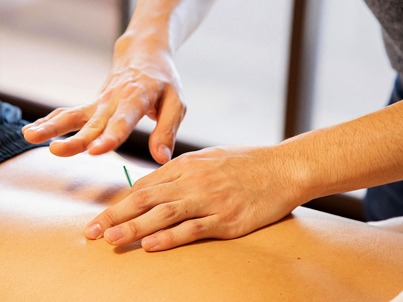Electro Acupuncture for Pain